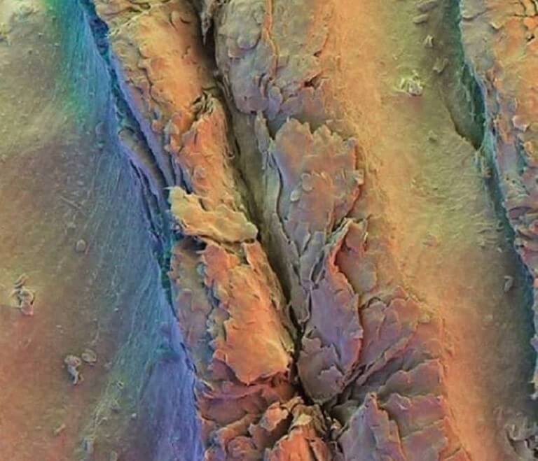 11 partes do corpo humano vistas pelo do microscópio