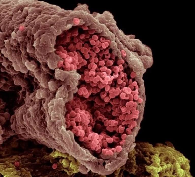 11 partes do corpo humano vistas pelo do microscópio